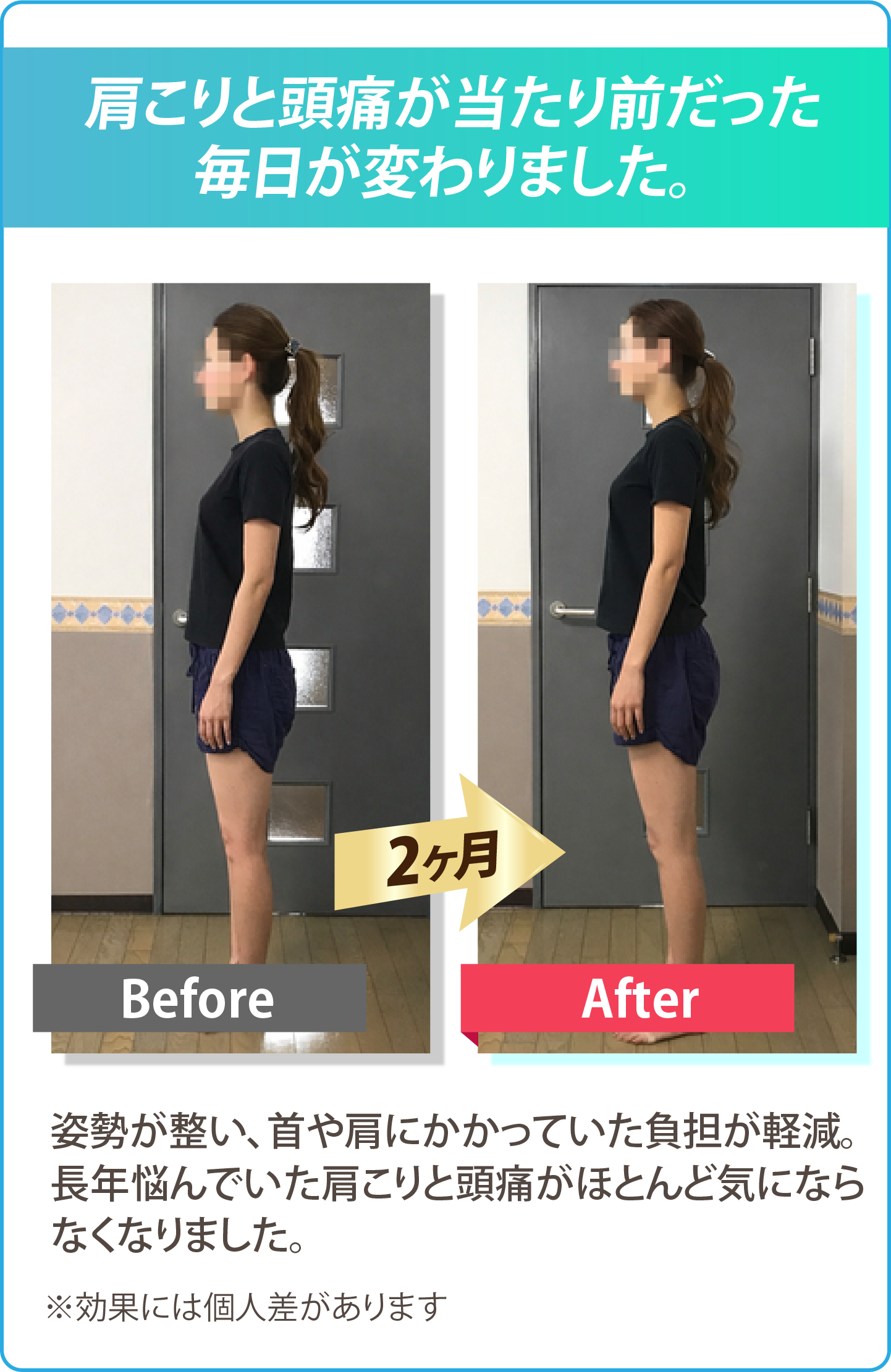 肩こり頭痛改善のビフォーアフター 姿勢改善